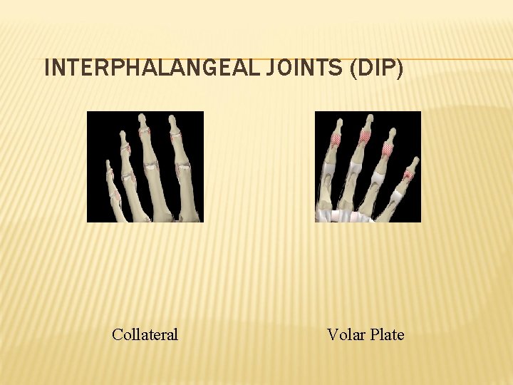 INTERPHALANGEAL JOINTS (DIP) Collateral Volar Plate 