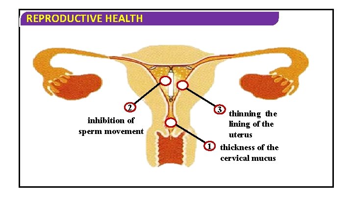 REPRODUCTIVE HEALTH 2 inhibition of sperm movement 3 thinning the lining of the uterus