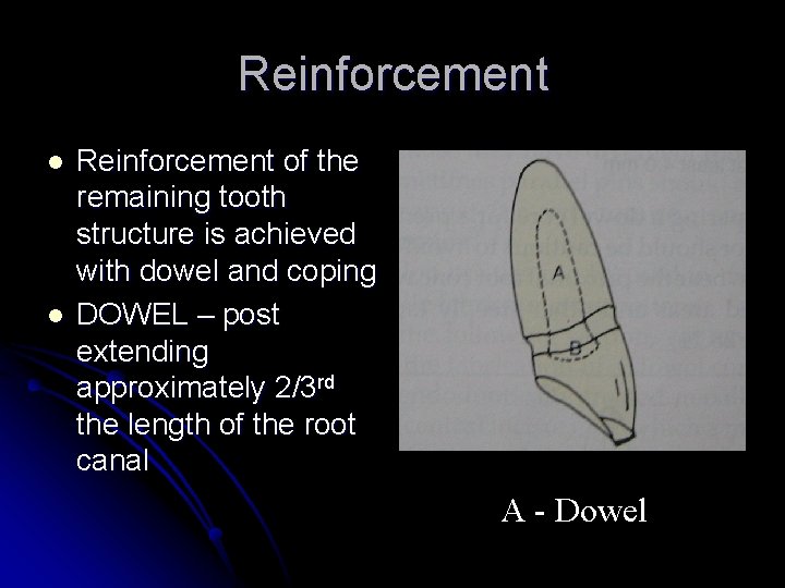 Reinforcement l l Reinforcement of the remaining tooth structure is achieved with dowel and