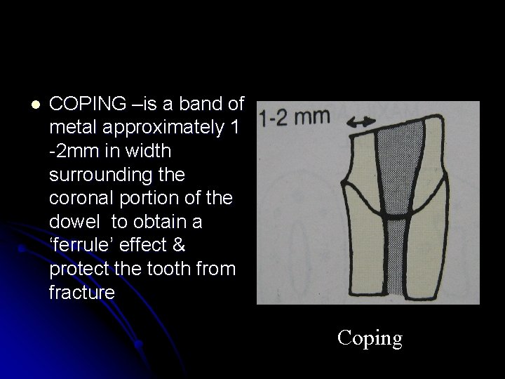 l COPING –is a band of metal approximately 1 -2 mm in width surrounding