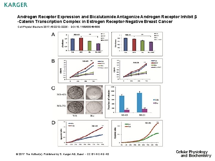 Androgen Receptor Expression and Bicalutamide Antagonize Androgen Receptor Inhibit β -Catenin Transcription Complex in