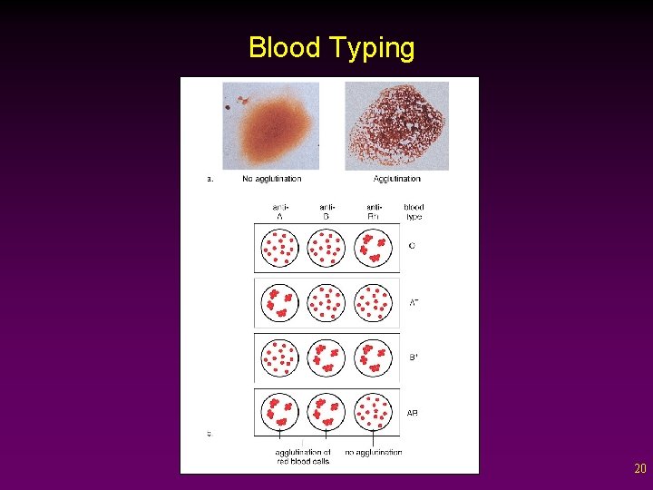 Blood Typing 20 
