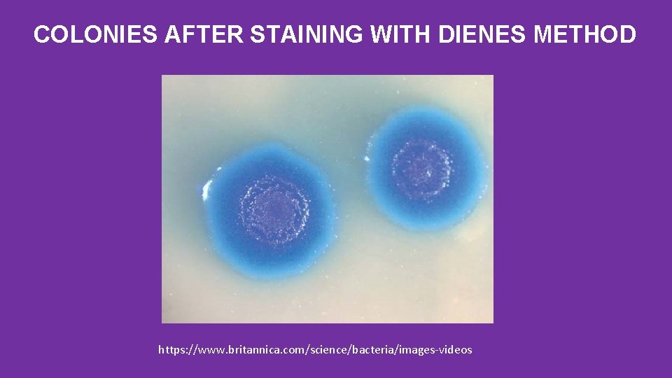 COLONIES AFTER STAINING WITH DIENES METHOD https: //www. britannica. com/science/bacteria/images-videos 