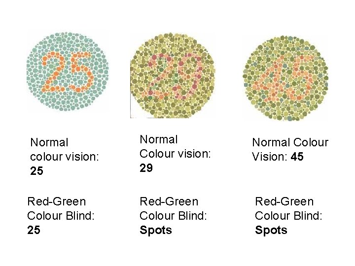 Normal colour vision: 25 Normal Colour vision: 29 Normal Colour Vision: 45 Red-Green Colour