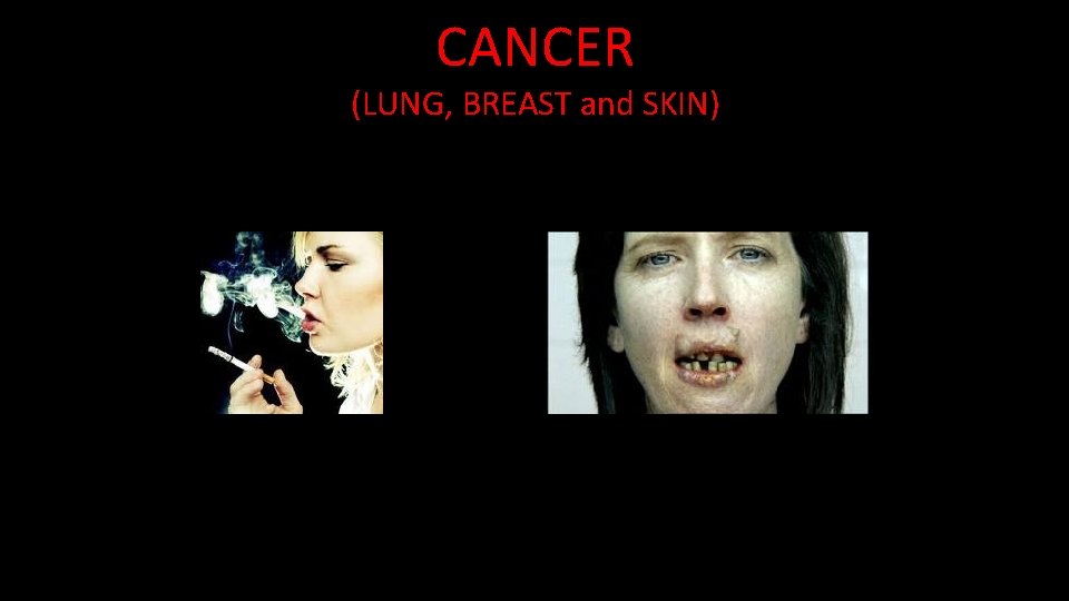 CANCER (LUNG, BREAST and SKIN) 