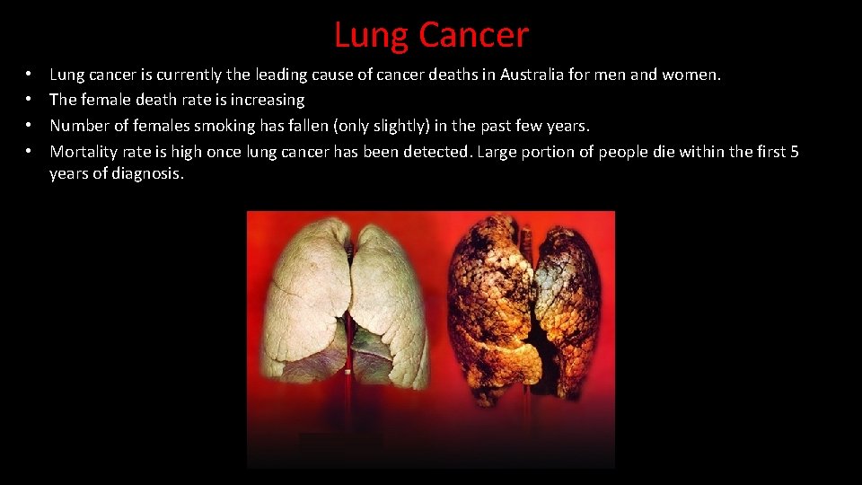 Lung Cancer • • Lung cancer is currently the leading cause of cancer deaths