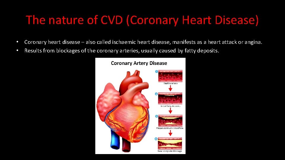 The nature of CVD (Coronary Heart Disease) • Coronary heart disease – also called
