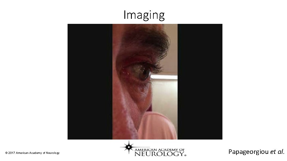 Imaging © 2017 American Academy of Neurology Papageorgiou et al. 
