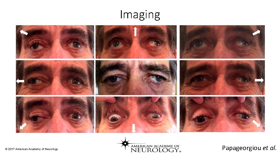 Imaging © 2017 American Academy of Neurology Papageorgiou et al. 