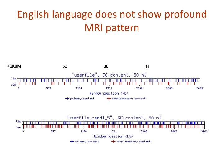 English language does not show profound MRI pattern 