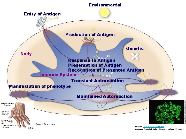 Environmental Entry of Antigen Production of Antigen Genetic Body Response to Antigen Presentation of