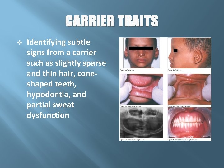CARRIER TRAITS v Identifying subtle signs from a carrier such as slightly sparse and