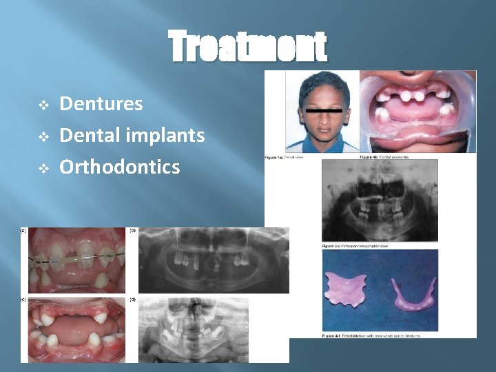 Treatment v v v Dentures Dental implants Orthodontics 