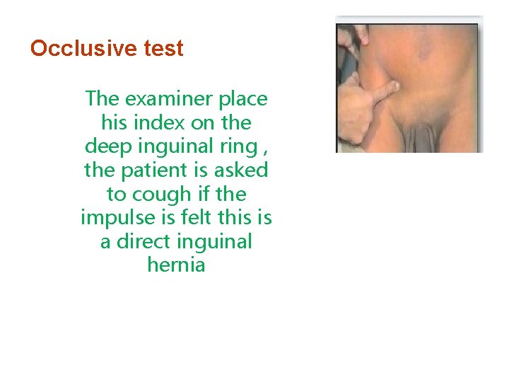 Occlusive test The examiner place his index on the deep inguinal ring , the