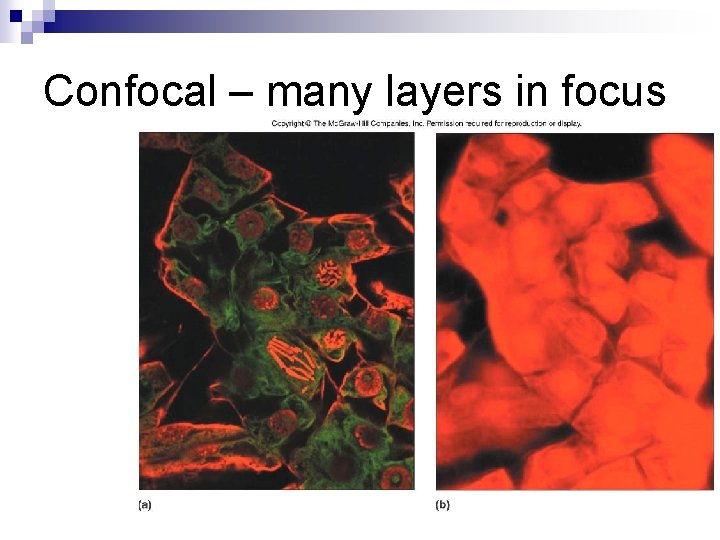 Confocal – many layers in focus 