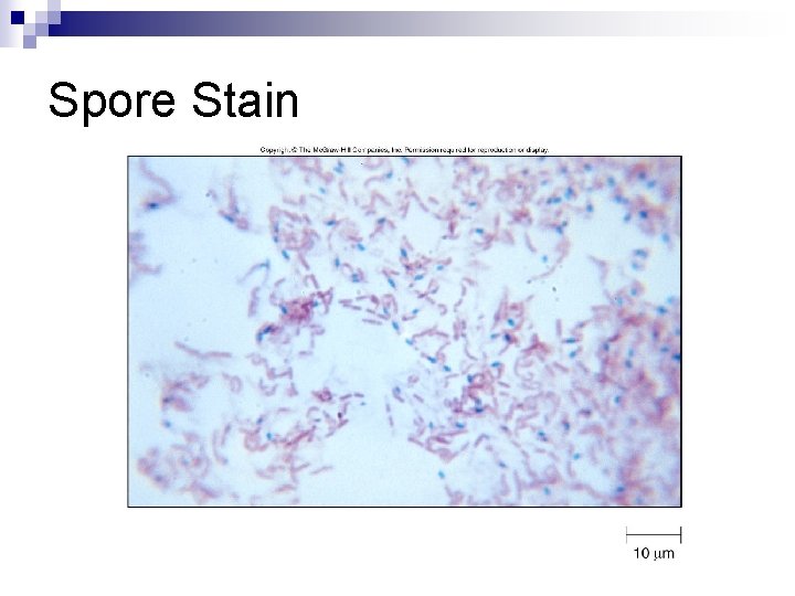Spore Stain 