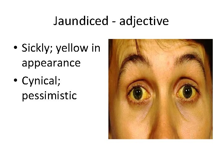 Jaundiced - adjective • Sickly; yellow in appearance • Cynical; pessimistic 