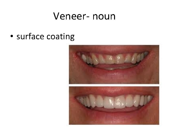 Veneer- noun • surface coating 