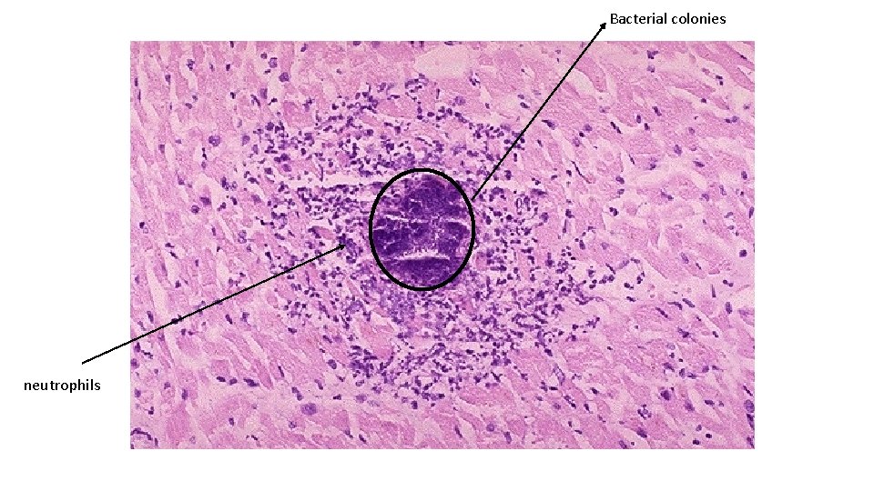 Bacterial colonies neutrophils 