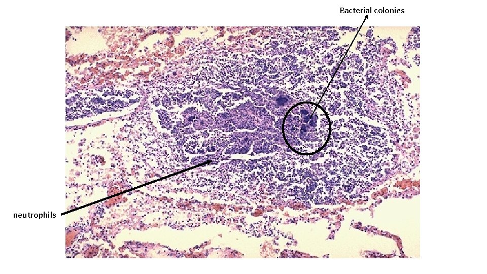 Bacterial colonies neutrophils 