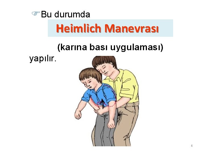  Bu durumda Heimlich Manevrası (karına bası uygulaması) yapılır. 4 