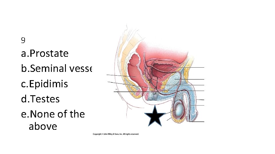 9 a. Prostate b. Seminal vessel c. Epidimis d. Testes e. None of the