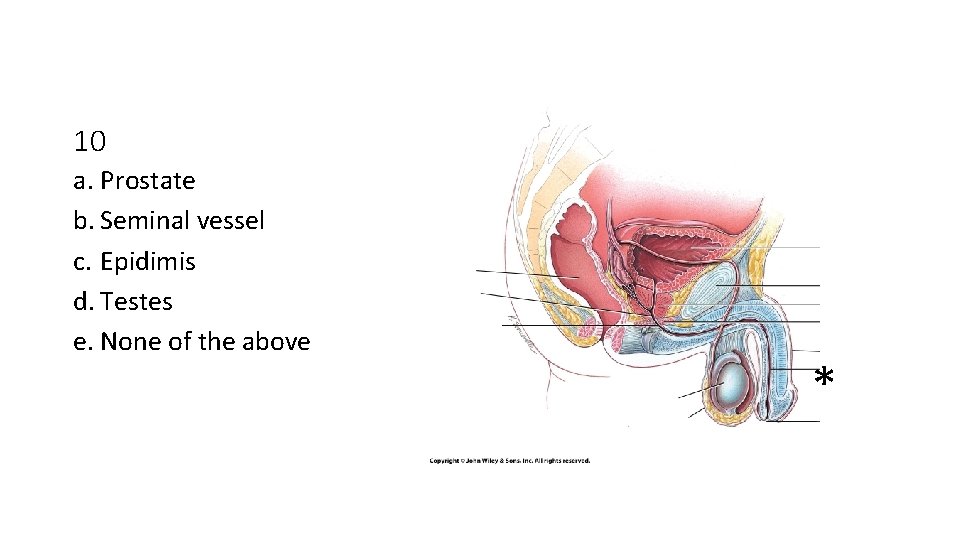10 a. Prostate b. Seminal vessel c. Epidimis d. Testes e. None of the