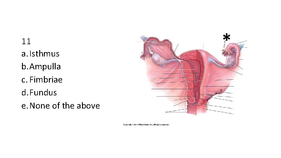 11 a. Isthmus b. Ampulla c. Fimbriae d. Fundus e. None of the above