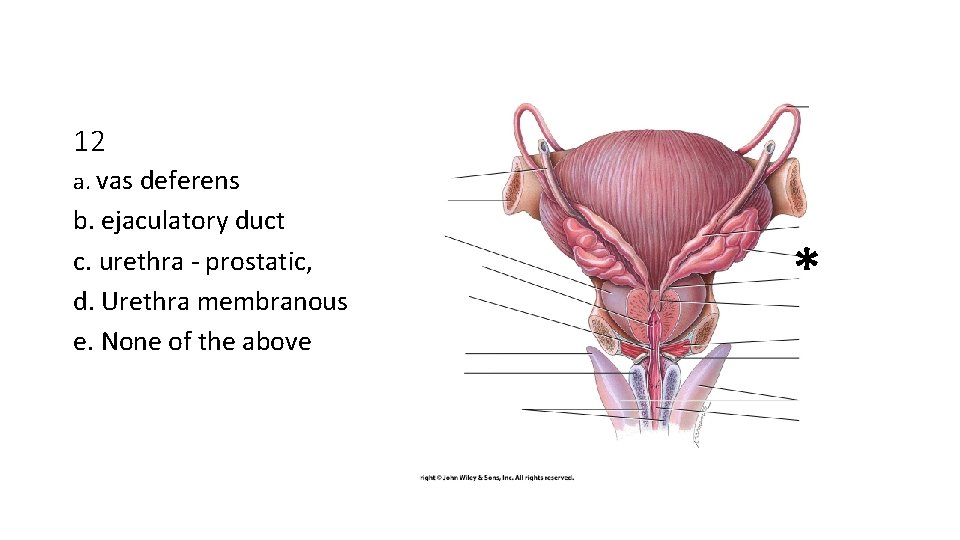 12 a. vas deferens b. ejaculatory duct c. urethra - prostatic, d. Urethra membranous