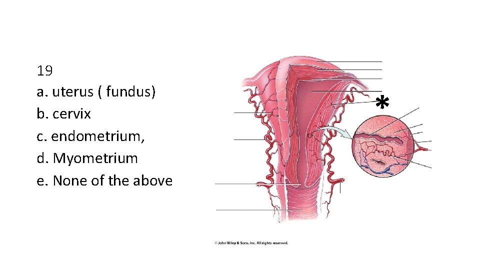 19 a. uterus ( fundus) b. cervix c. endometrium, d. Myometrium e. None of