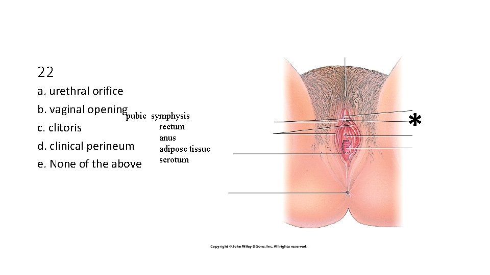 22 a. urethral orifice b. vaginal openingpubic c. clitoris d. clinical perineum e. None