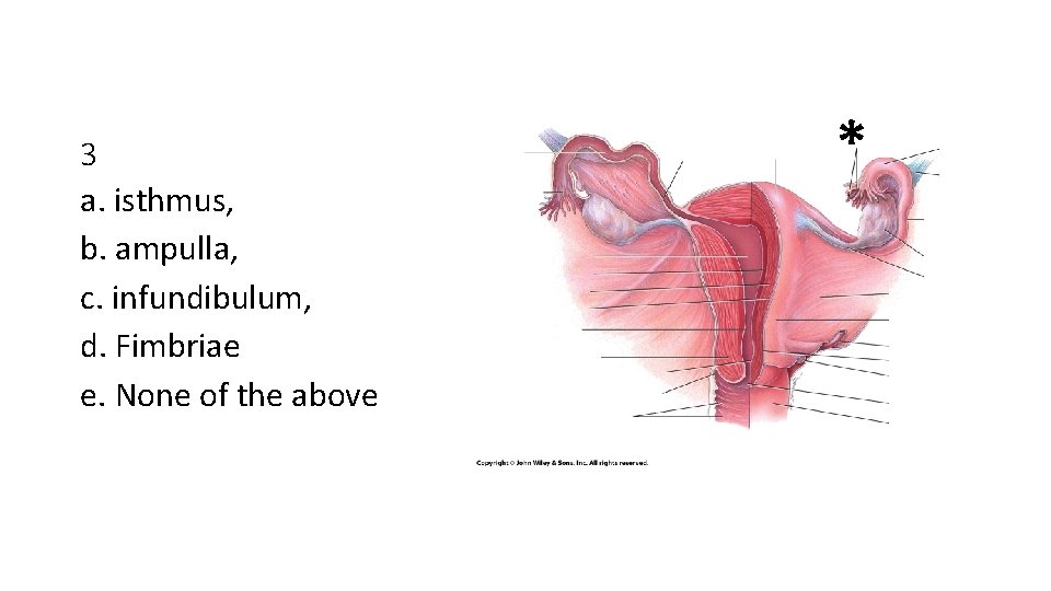 3 a. isthmus, b. ampulla, c. infundibulum, d. Fimbriae e. None of the above