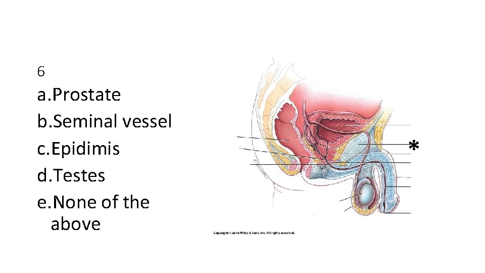 6 a. Prostate b. Seminal vessel c. Epidimis d. Testes e. None of the