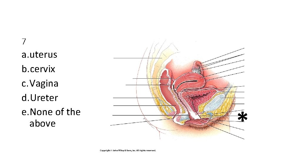 7 a. uterus b. cervix c. Vagina d. Ureter e. None of the above