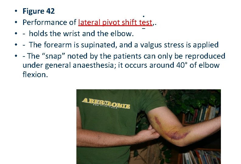  • • • Figure 42. Performance of lateral pivot shift test, . -