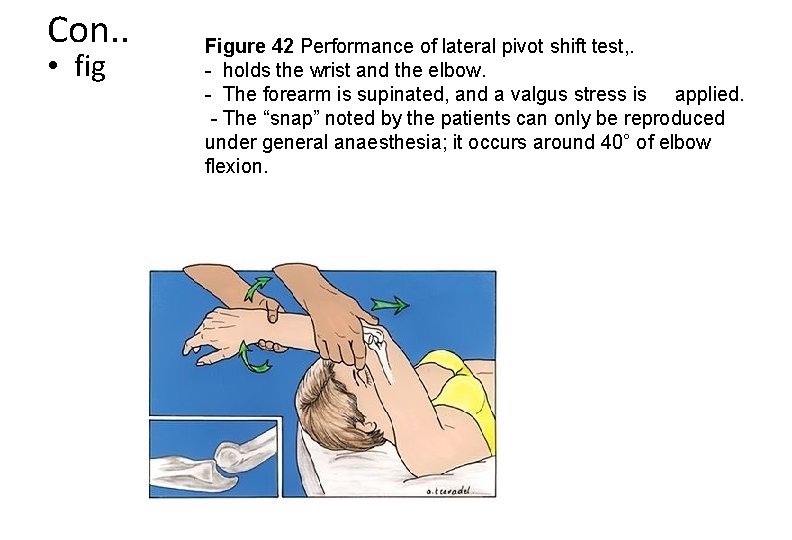 Con. . • fig Figure 42 Performance of lateral pivot shift test, . -