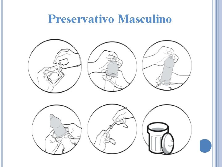 Preservativo Masculino 