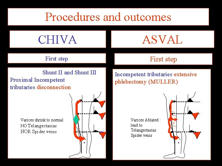 Procedures and outcomes CHIVA ASVAL First step Shunt II and Shunt III Proximal Incompetent