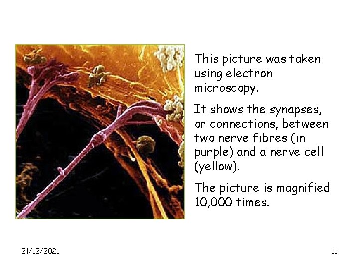 This picture was taken using electron microscopy. It shows the synapses, or connections, between