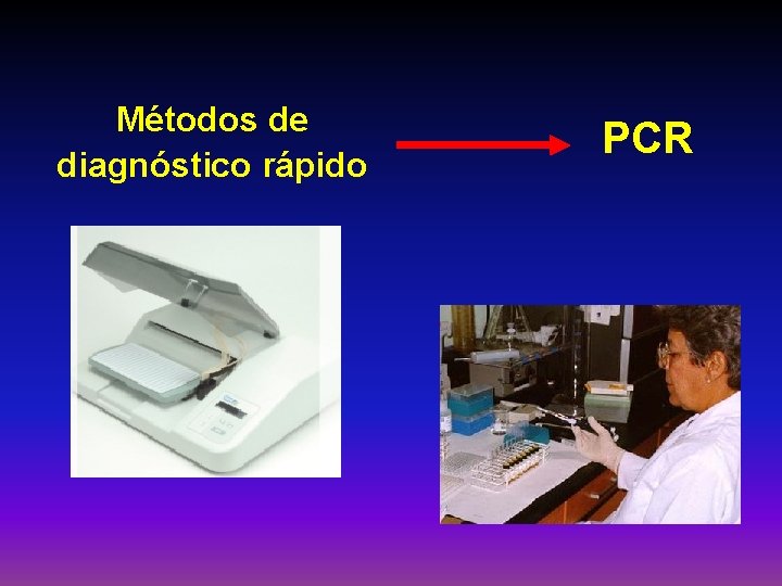 Métodos de diagnóstico rápido PCR 