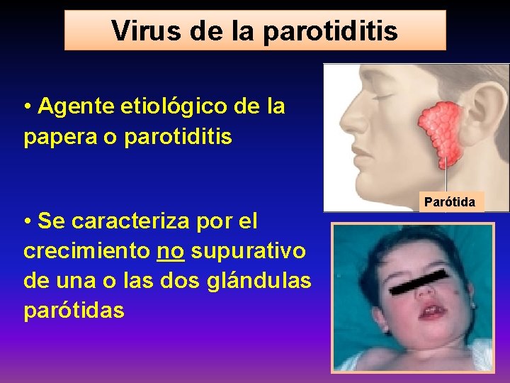 Virus de la parotiditis • Agente etiológico de la papera o parotiditis • Se