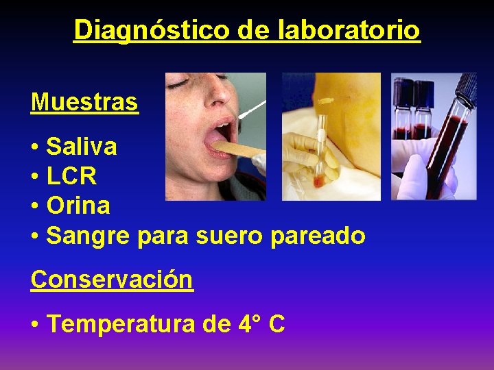Diagnóstico de laboratorio Muestras • Saliva • LCR • Orina • Sangre para suero