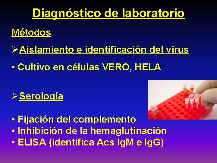 Diagnóstico de laboratorio Métodos ØAislamiento e identificación del virus • Cultivo en células VERO,