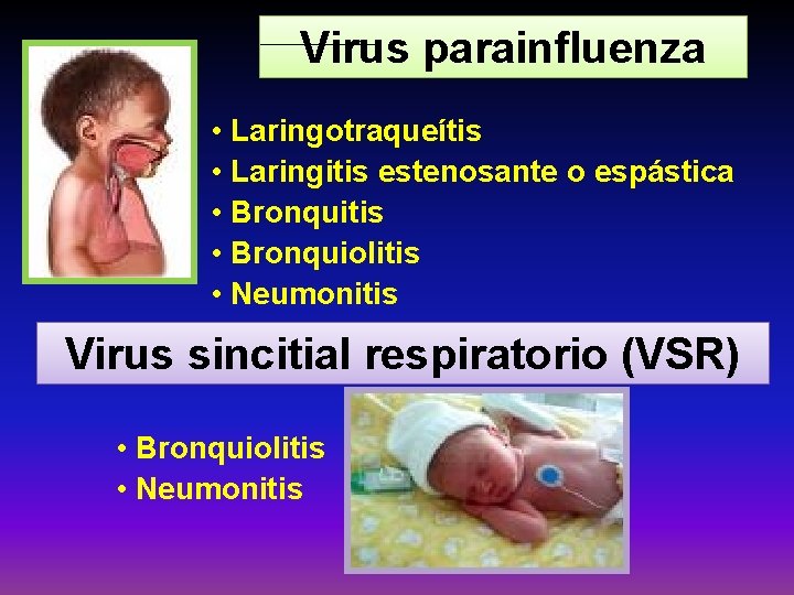 Virus parainfluenza • Laringotraqueítis • Laringitis estenosante o espástica • Bronquitis • Bronquiolitis •