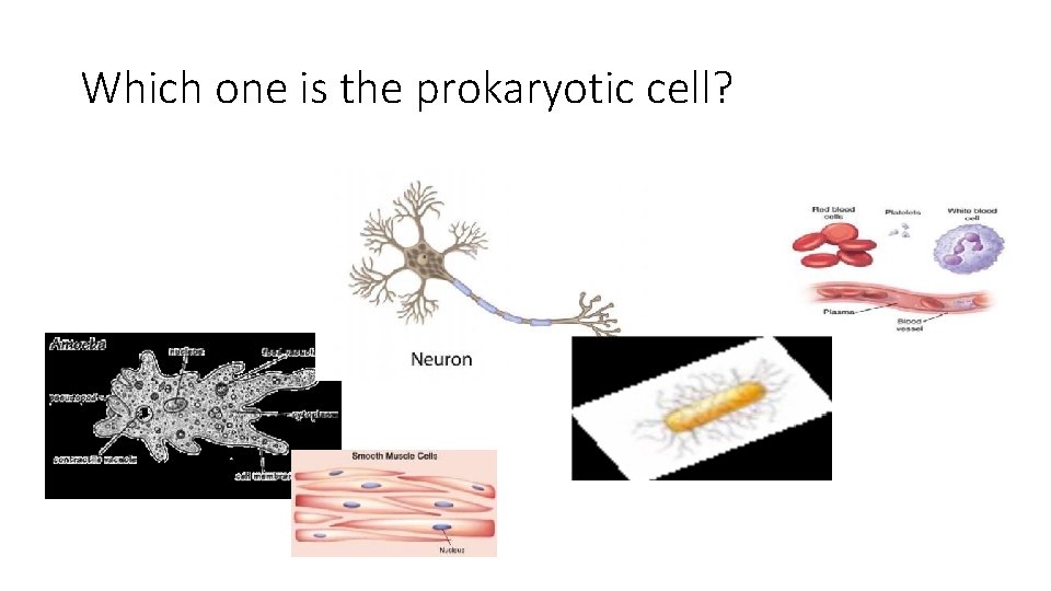 Which one is the prokaryotic cell? 