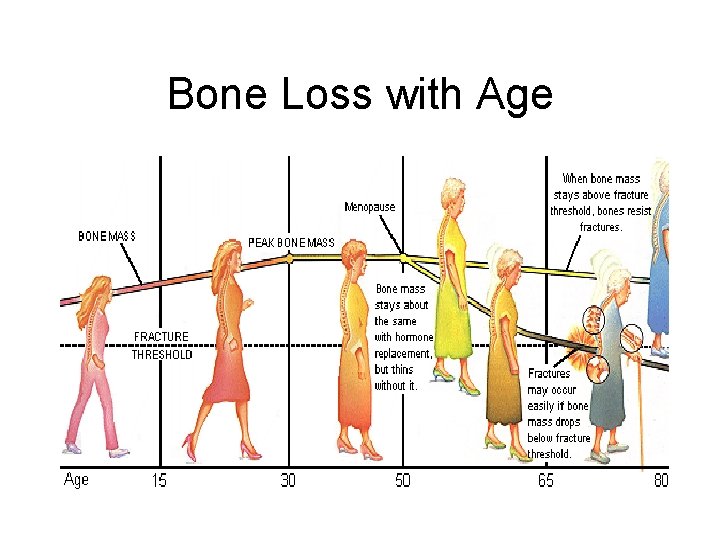 Bone Loss with Age 