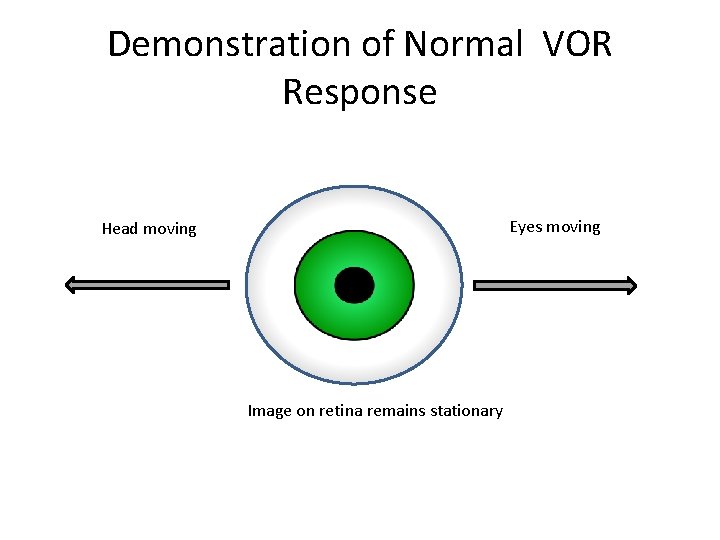 Demonstration of Normal VOR Response Eyes moving Head moving Image on retina remains stationary Demonstration of Normal VOR Response Eyes moving Head moving Image on retina remains stationary