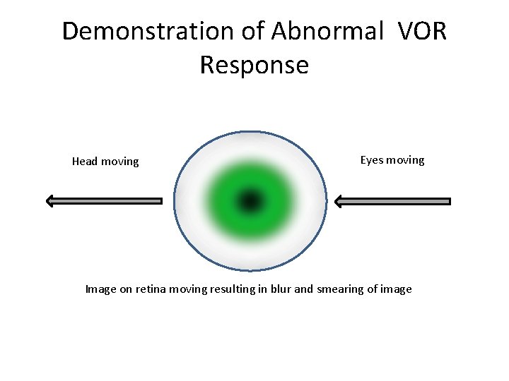 Demonstration of Abnormal VOR Response Head moving Eyes moving Image on retina moving resulting Demonstration of Abnormal VOR Response Head moving Eyes moving Image on retina moving resulting