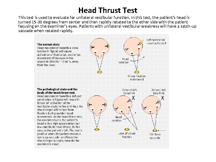 Head Thrust Test This test is used to evaluate for unilateral vestibular function. In Head Thrust Test This test is used to evaluate for unilateral vestibular function. In