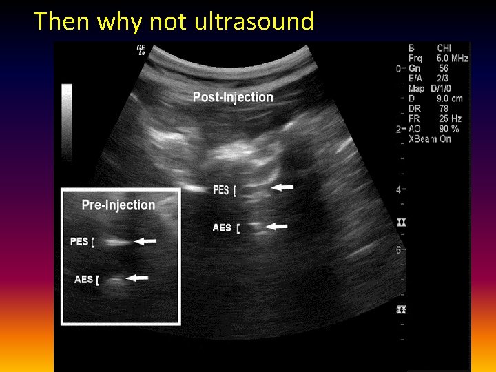 Then why not ultrasound 